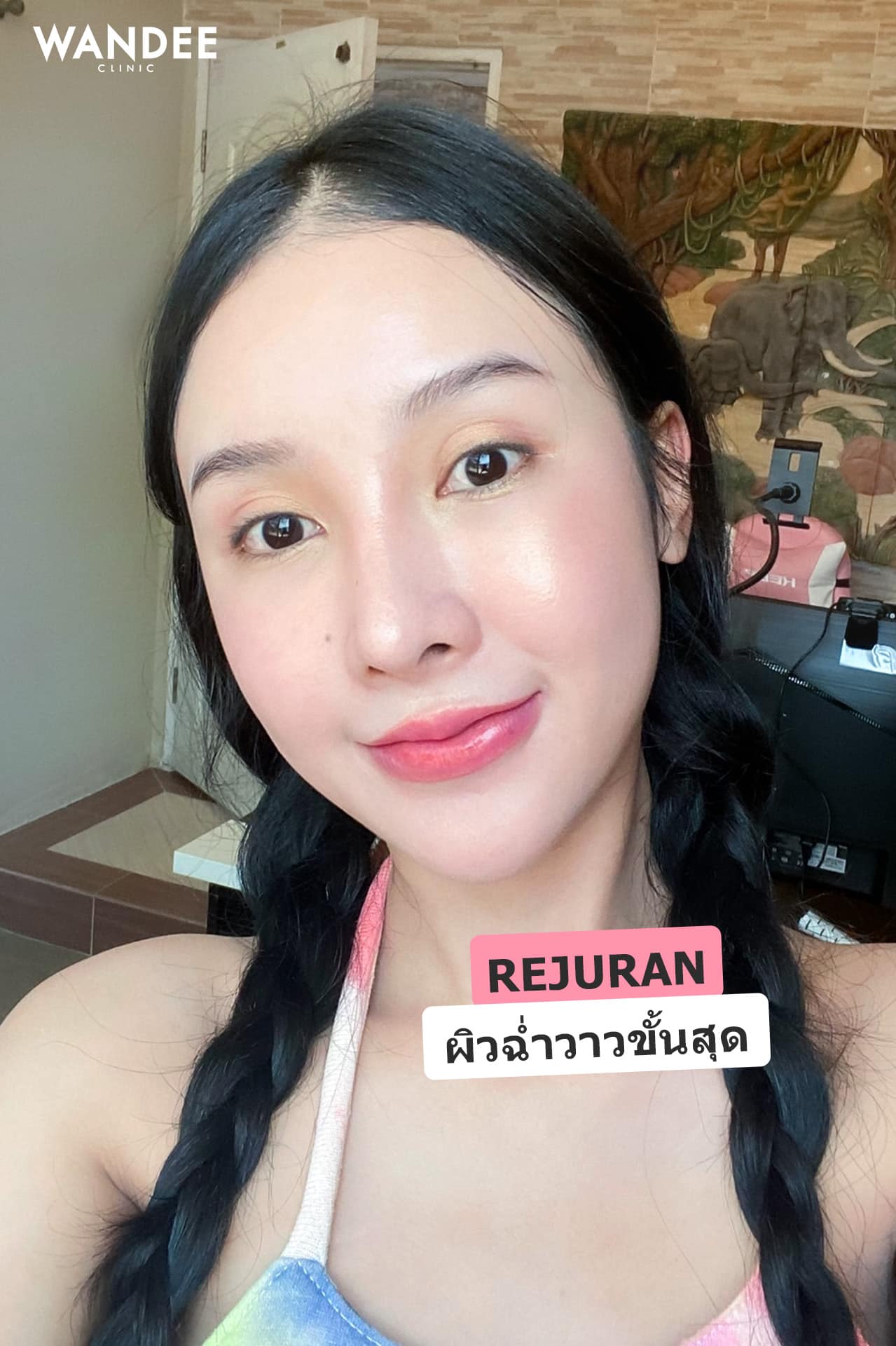 หลังฉีด 𝐑𝐞𝐣𝐮𝐫𝐚𝐧