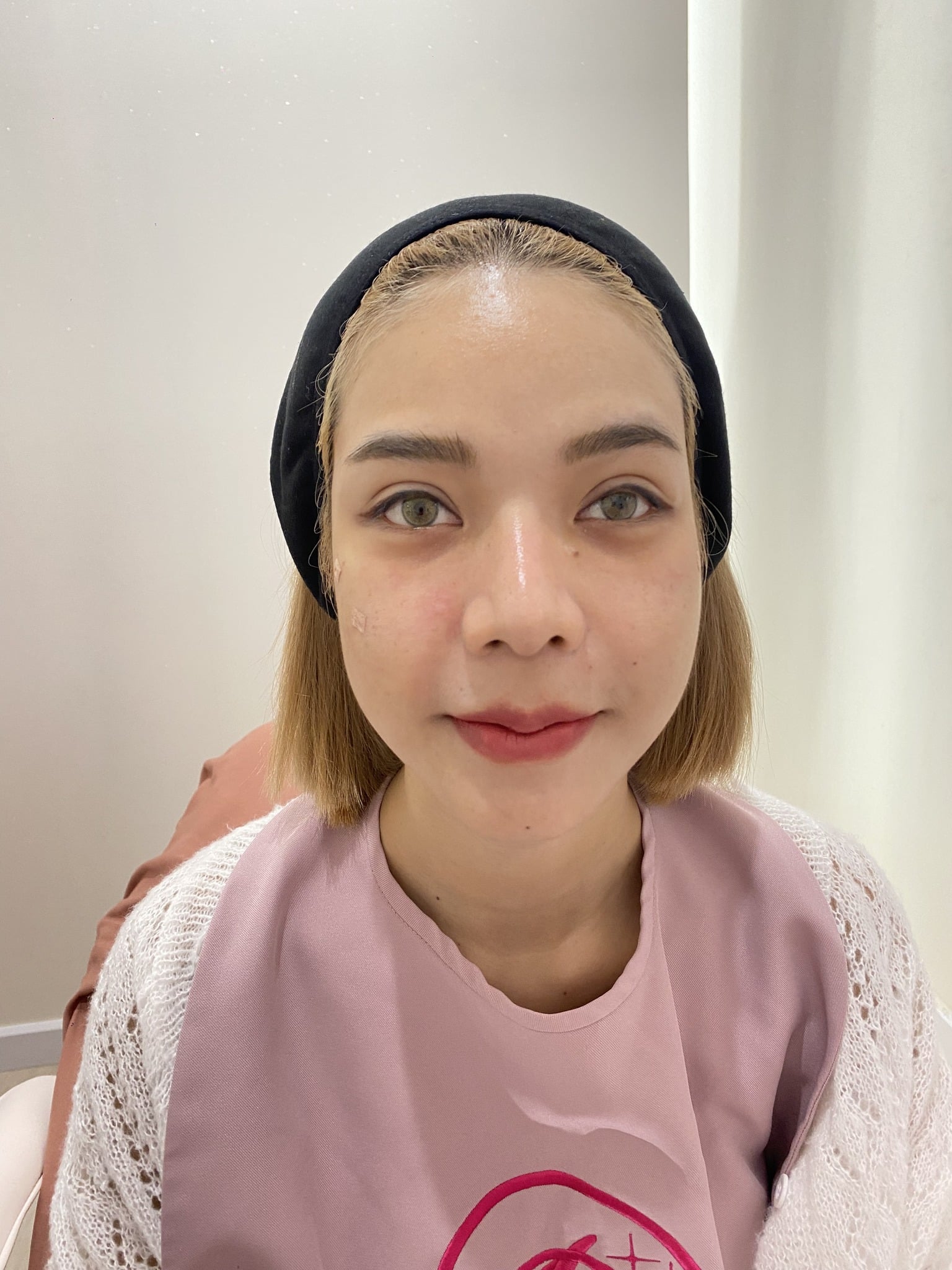 𝗙𝗜𝗟𝗟𝗘𝗥 เติมใต้ตา