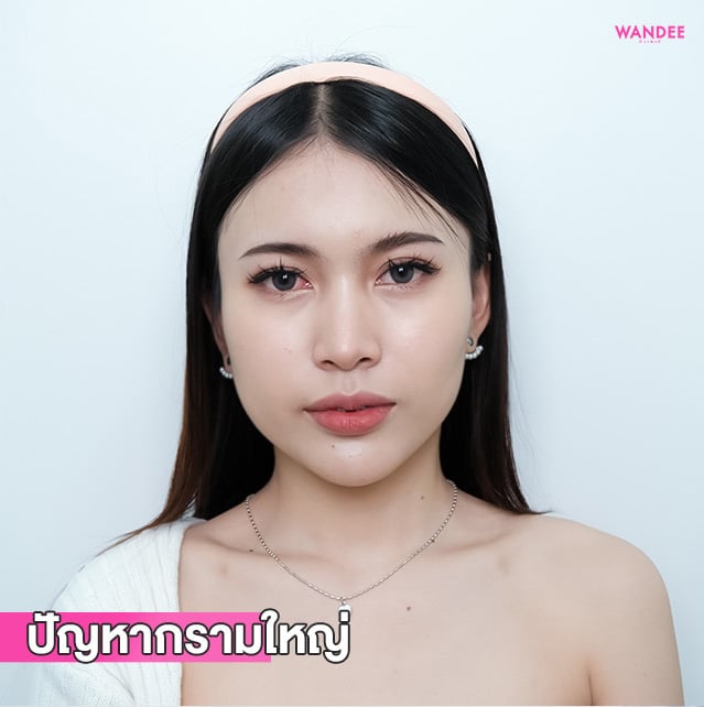 𝗕𝗢𝗧𝗢𝗫 ลดกราม