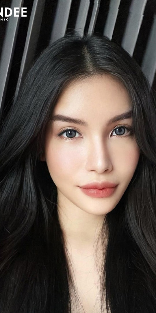 𝗙𝗜𝗟𝗟𝗘𝗥 ปากสายฝอ