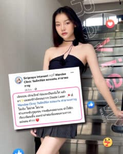 𝐋𝐀𝐒𝐄𝐑 ขนรักแร้