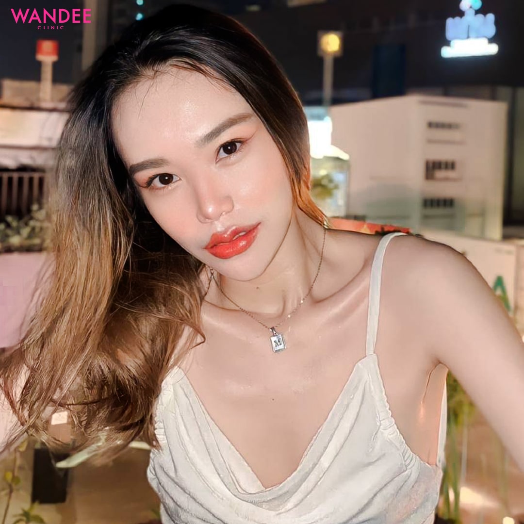 𝗙𝗜𝗟𝗟𝗘𝗥 ปาก อวบอิ่ม