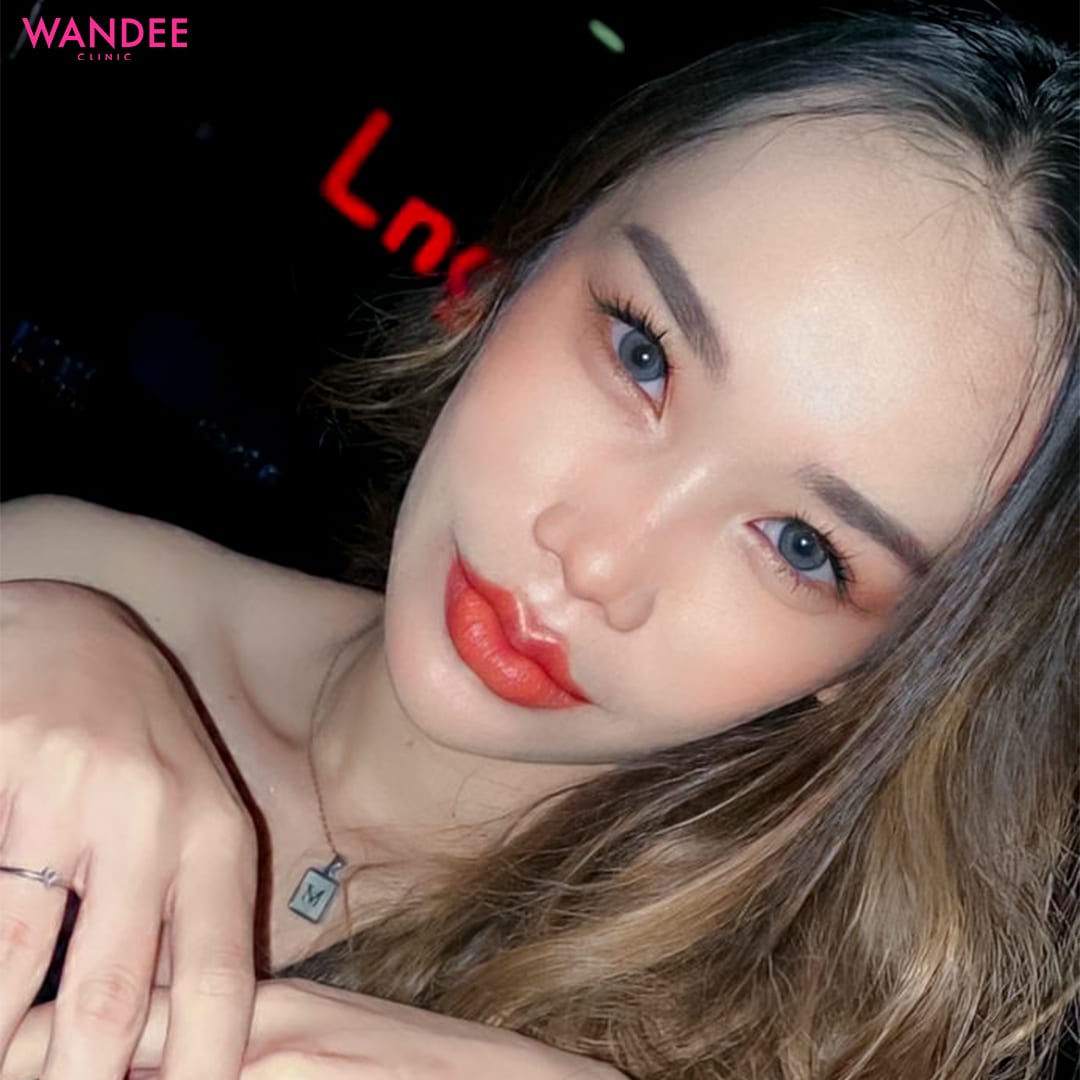 𝗙𝗜𝗟𝗟𝗘𝗥 ปาก อวบอิ่ม