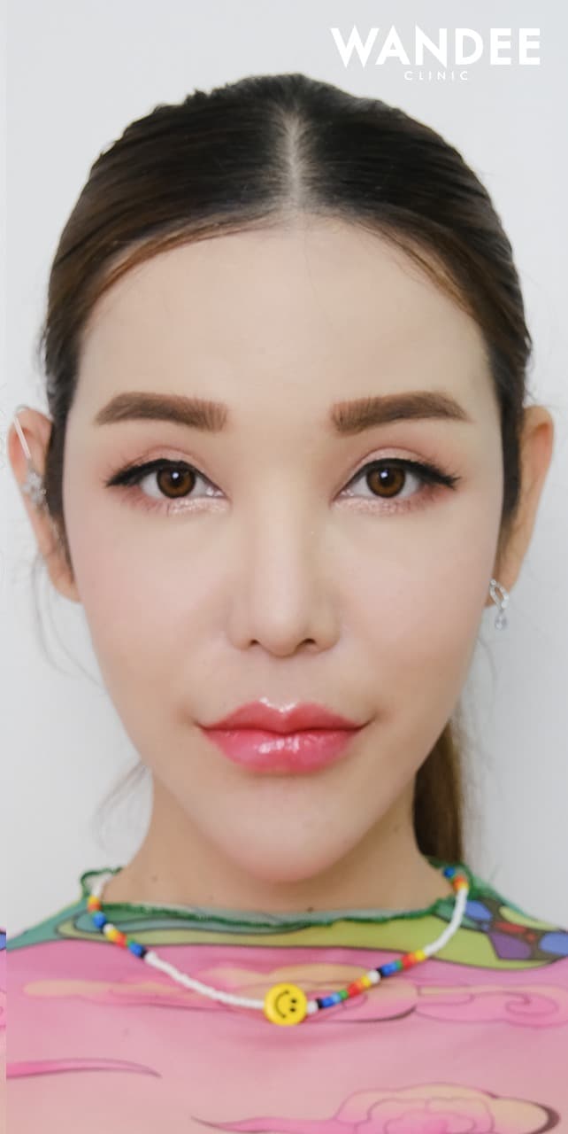 𝗙𝗜𝗟𝗟𝗘𝗥 ปาก