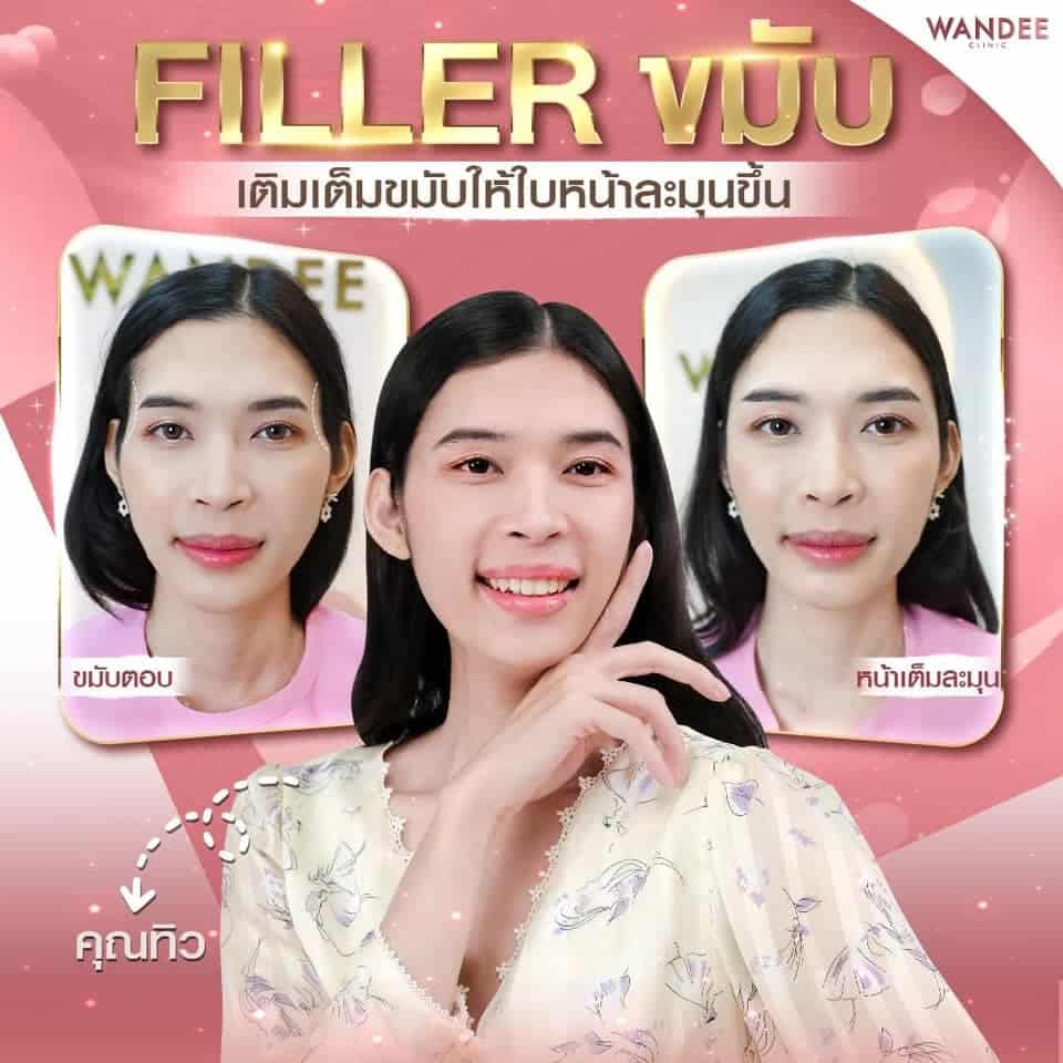 𝗙𝗜𝗟𝗟𝗘𝗥 ปรับโหงวเฮ้ง