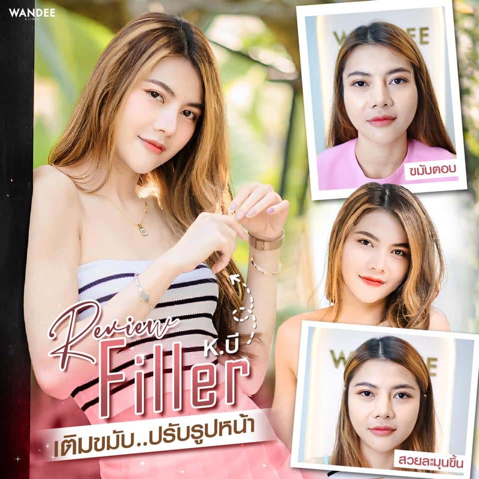 𝗙𝗜𝗟𝗟𝗘𝗥 ปรับโหงวเฮ้ง