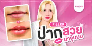 ฉีดฟิลเลอร์ปาก