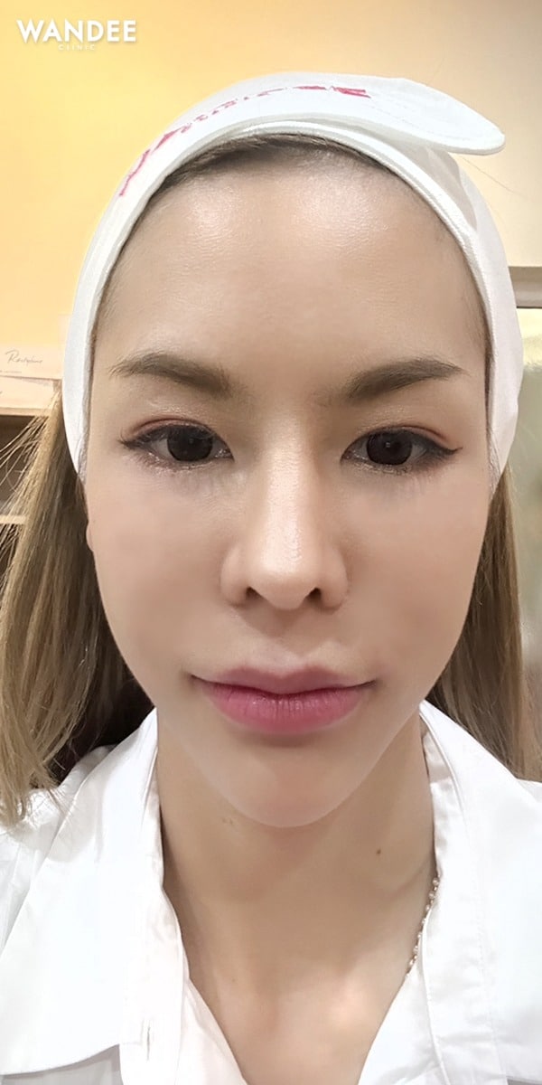 𝗙𝗶𝗹𝗹𝗲𝗿 ปากบาร์บี้