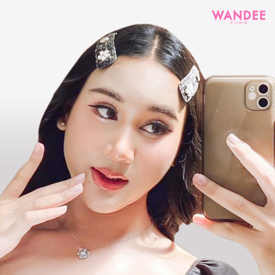 𝗙𝗜𝗟𝗟𝗘𝗥 ปากคุณแป้ง