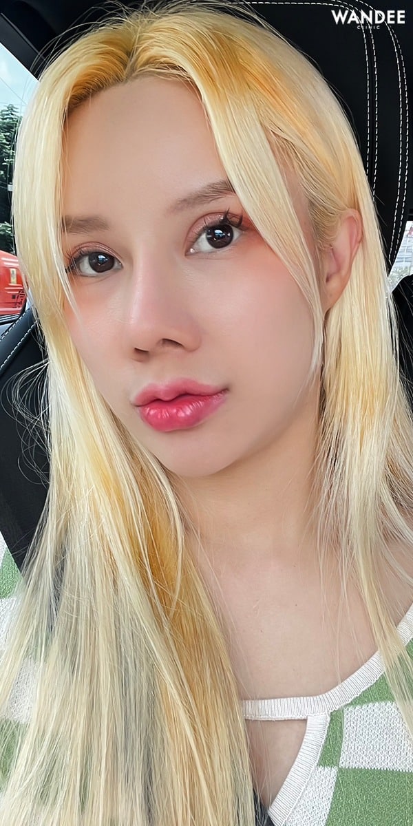 𝗙𝗜𝗟𝗟𝗘𝗥 ปากกระจับสวยทรงชัด