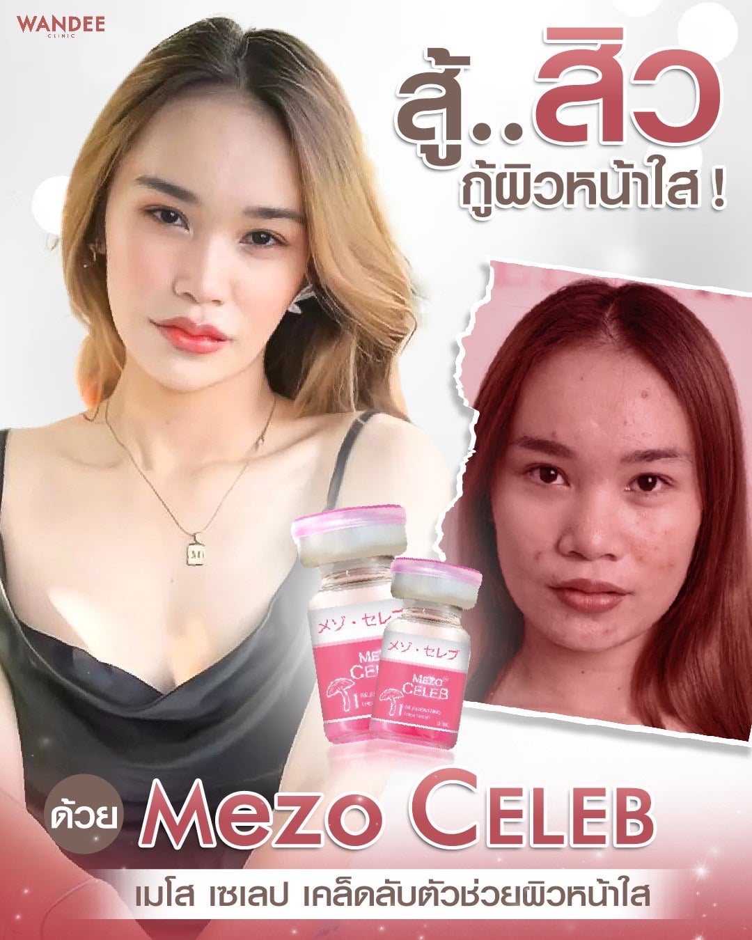 𝗠𝗘𝗭𝗢 𝗖𝗘𝗟𝗘𝗕