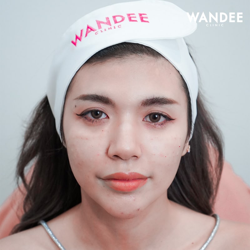 𝗥𝗘𝗝𝗨𝗥𝗔𝗡 บูสผิวใส