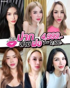 𝗙𝗜𝗟𝗟𝗘𝗥 ปากแบบตัวแม่