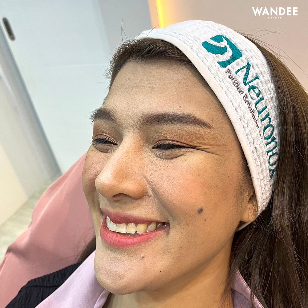 𝐁𝐎𝐓𝐎𝐗 ลดริ้วรอย