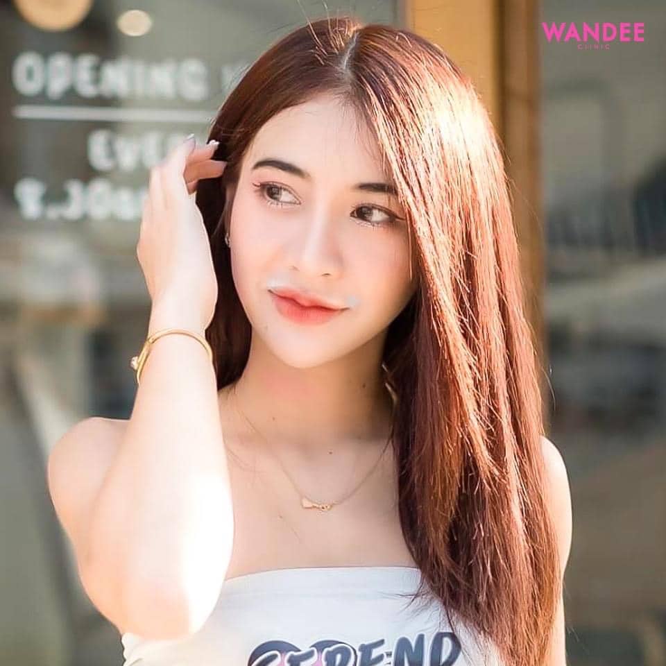 𝗙𝗶𝗹𝗹𝗲𝗿 เติมคางยาว