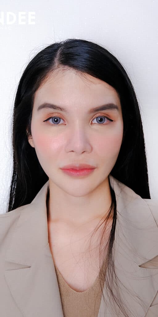 𝗙𝗜𝗟𝗟𝗘𝗥 ปาก