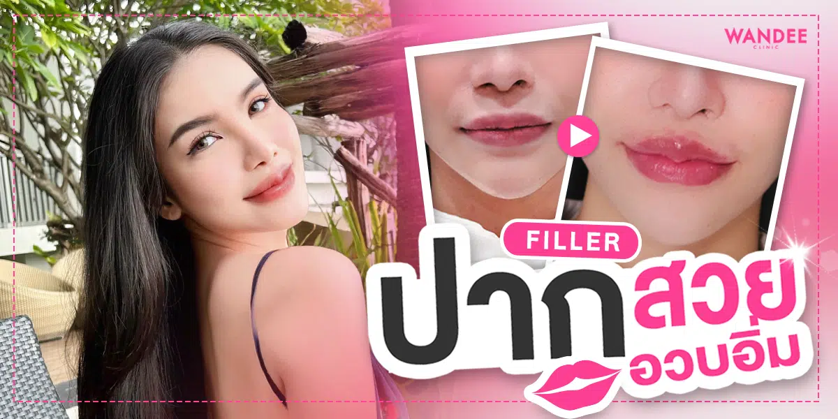 รีวิวฉีดฟิลเลอร์ปาก