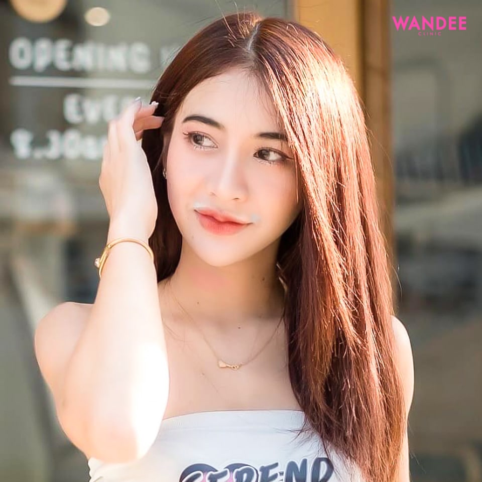 𝗙𝗜𝗟𝗟𝗘𝗥 คาง