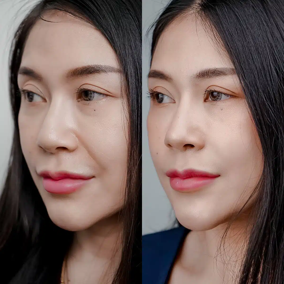 𝗕𝗢𝗧𝗢𝗫 VS 𝗙𝗜𝗟𝗟𝗘𝗥