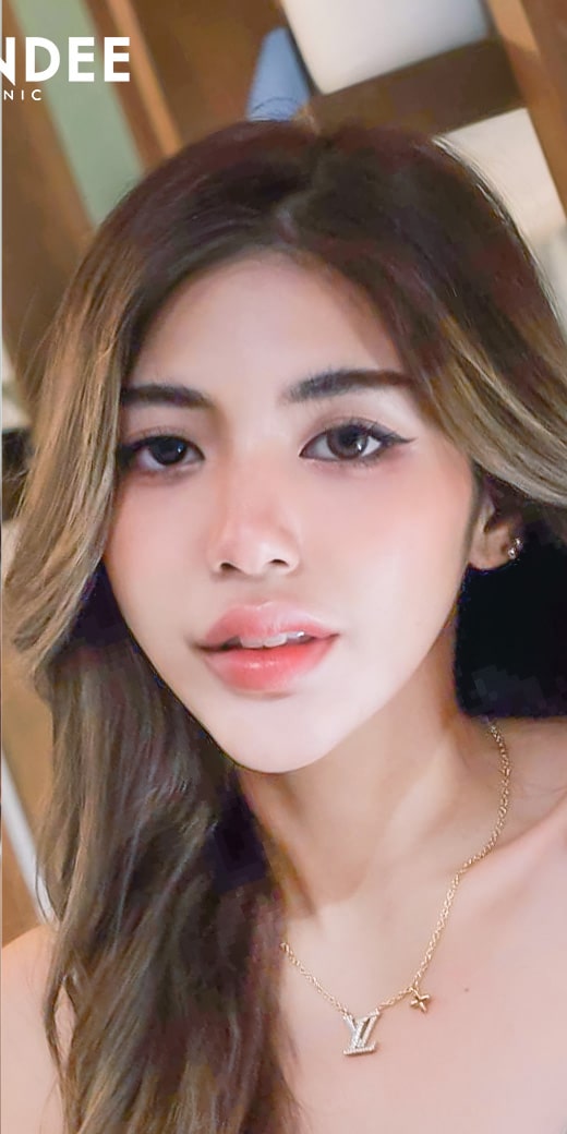 𝐑𝐞𝐣𝐮𝐫𝐚𝐧 บูสหน้าใส