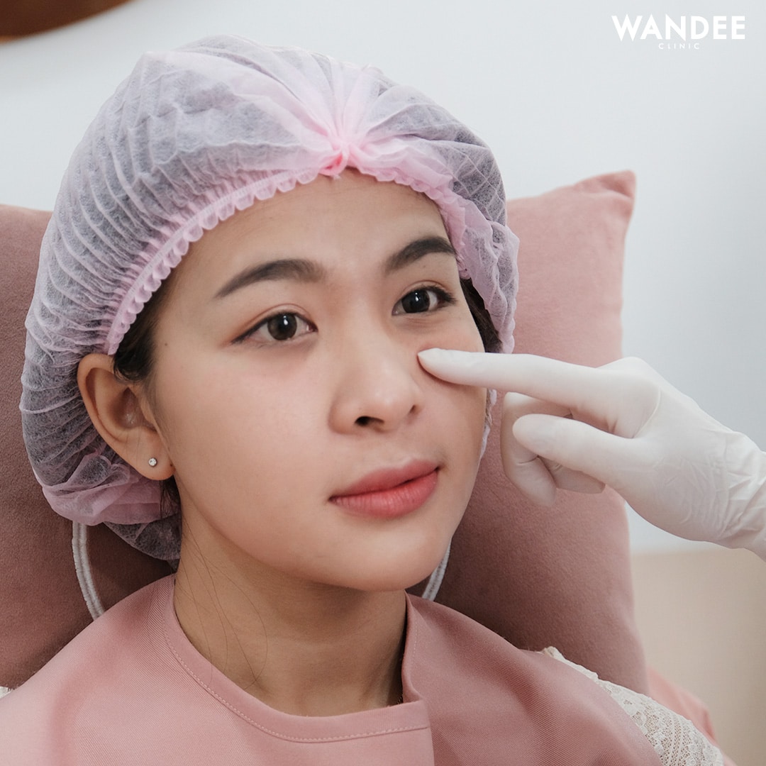 𝗙𝗜𝗟𝗟𝗘𝗥 ใต้ตา