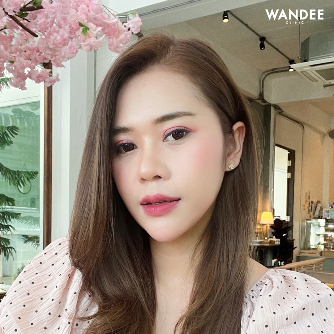 𝗕𝗢𝗧𝗢𝗫 ลดกราม