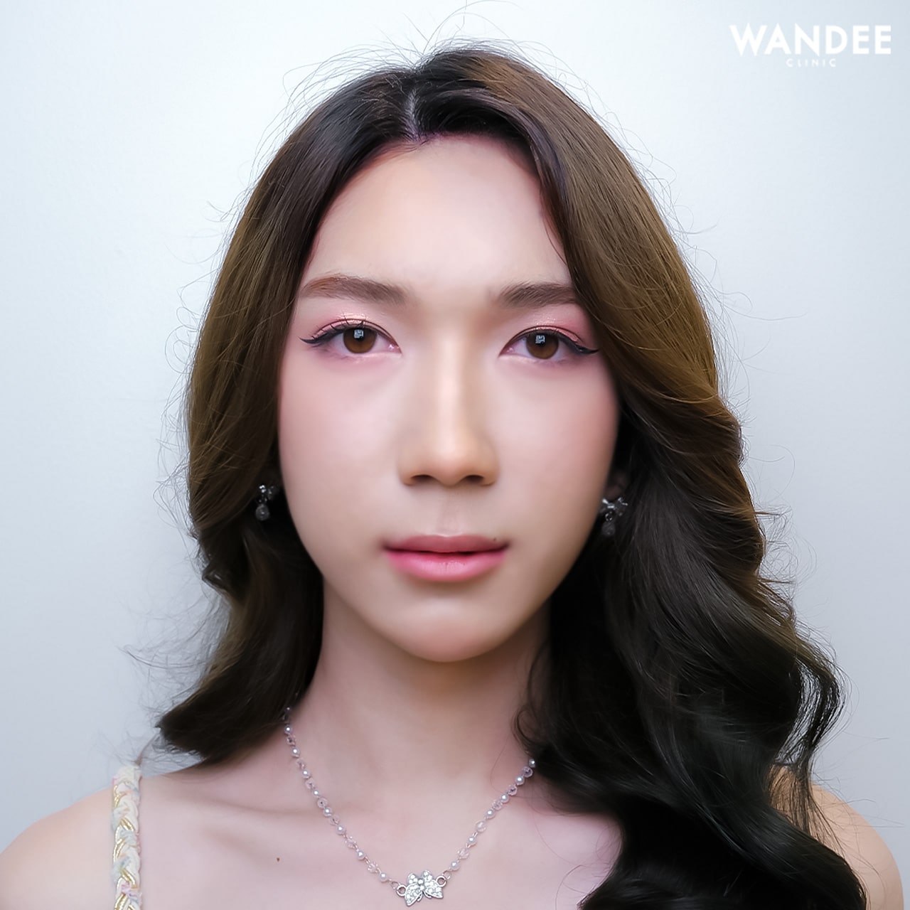 ฟิลเลอร์ปากสวยน่าจุ๊บ