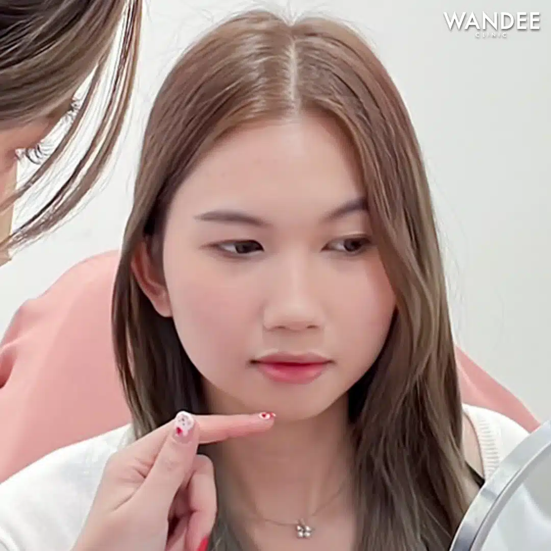 เติม 𝗙𝗜𝗟𝗟𝗘𝗥 ปาก
