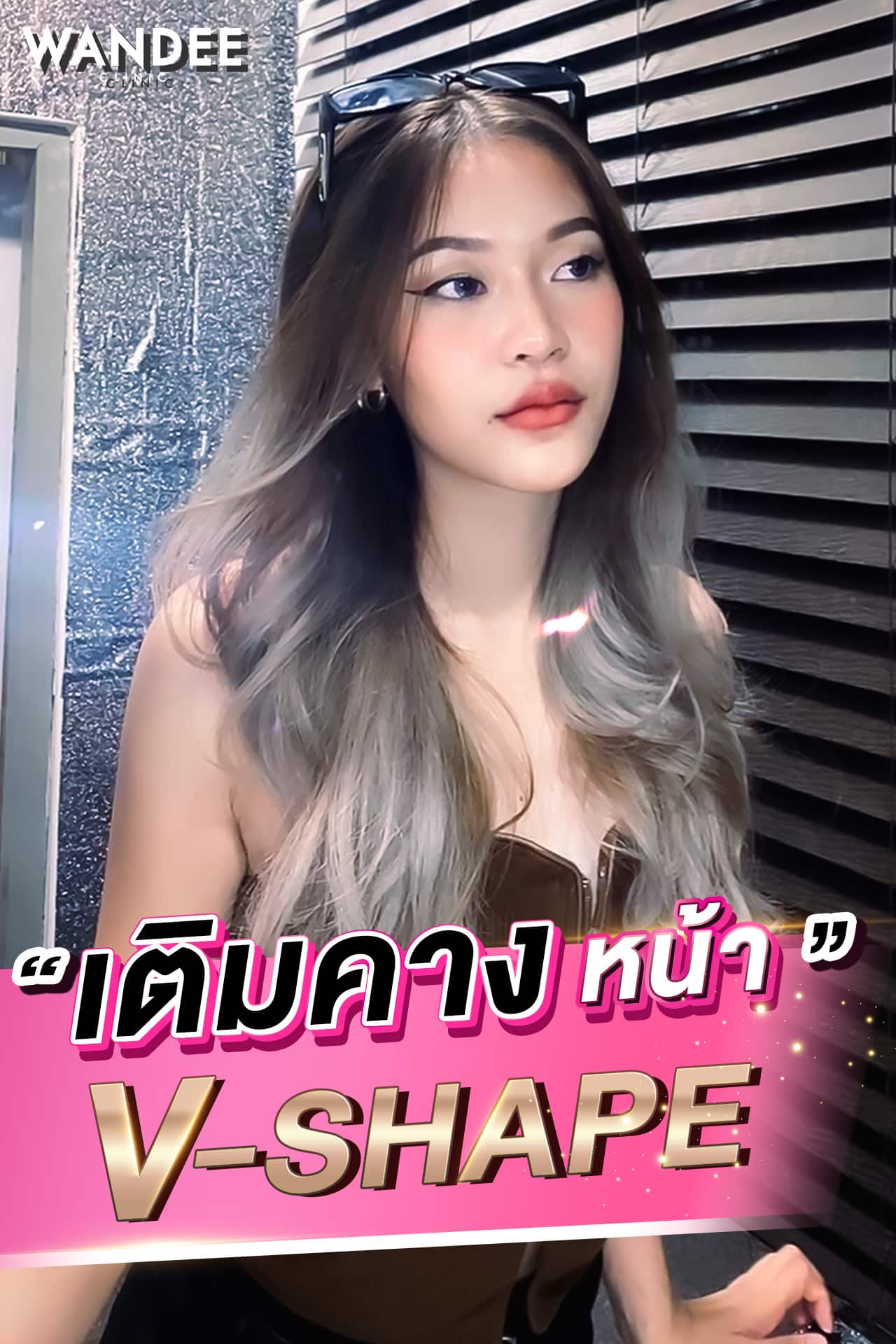 เติมคาง V-shape