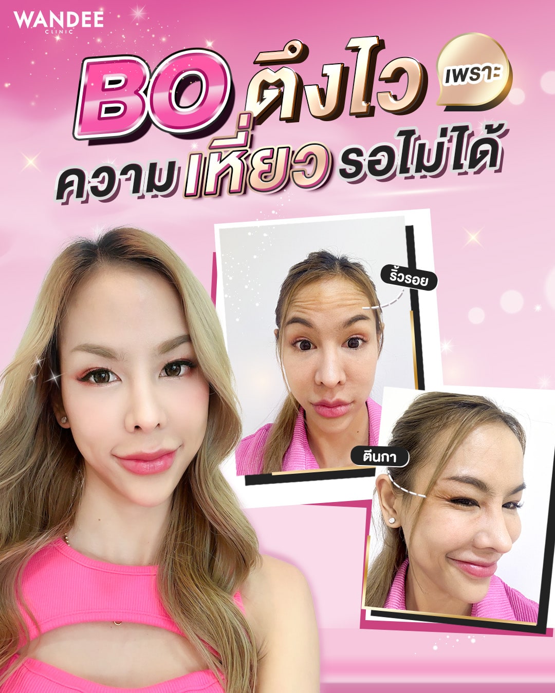 𝗕𝗢 ตึงไว