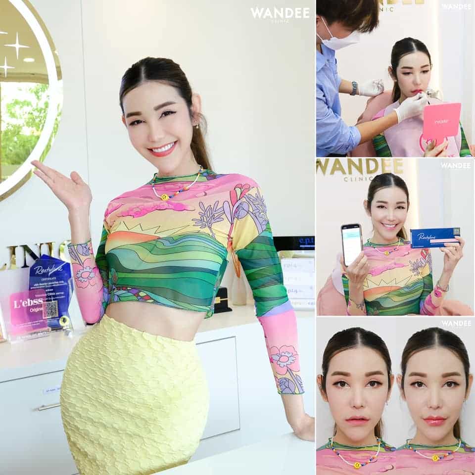 เติมปากดูอวบอิ่ม