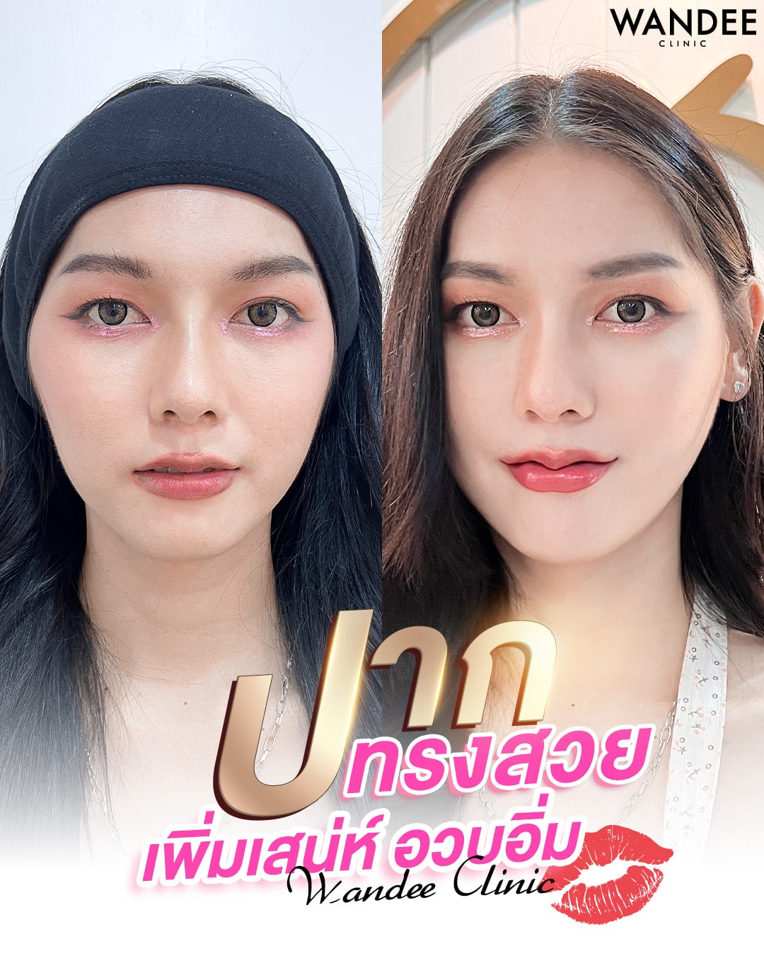 ปากกระจับสวยทรงชัด