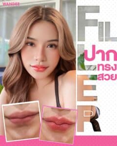 เติมปากแค่ 1 cc