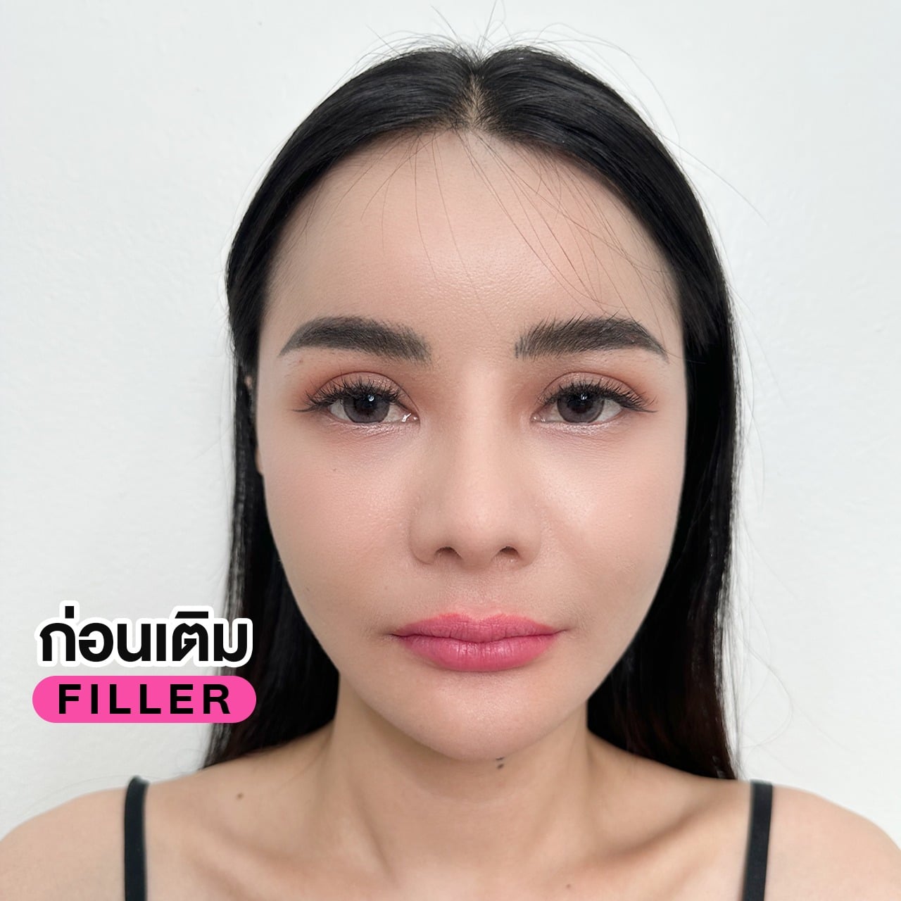 ปากอวบอิ่ม