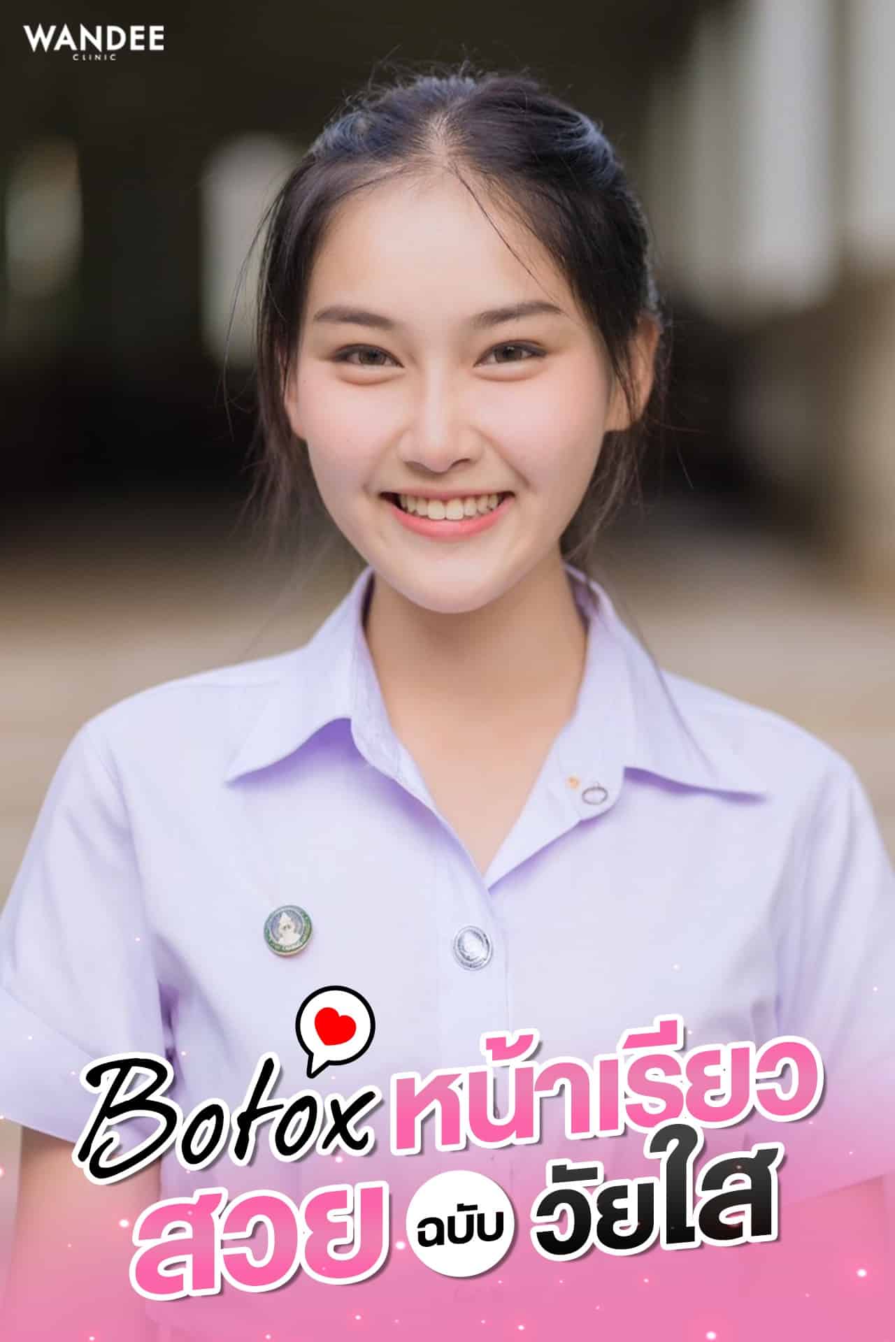 โบกราม V-Shape