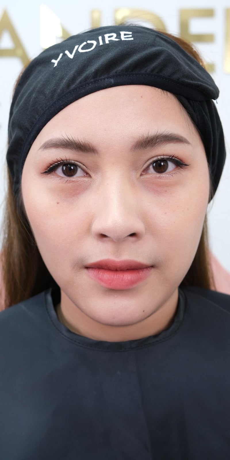 เติมร่องใต้ตา