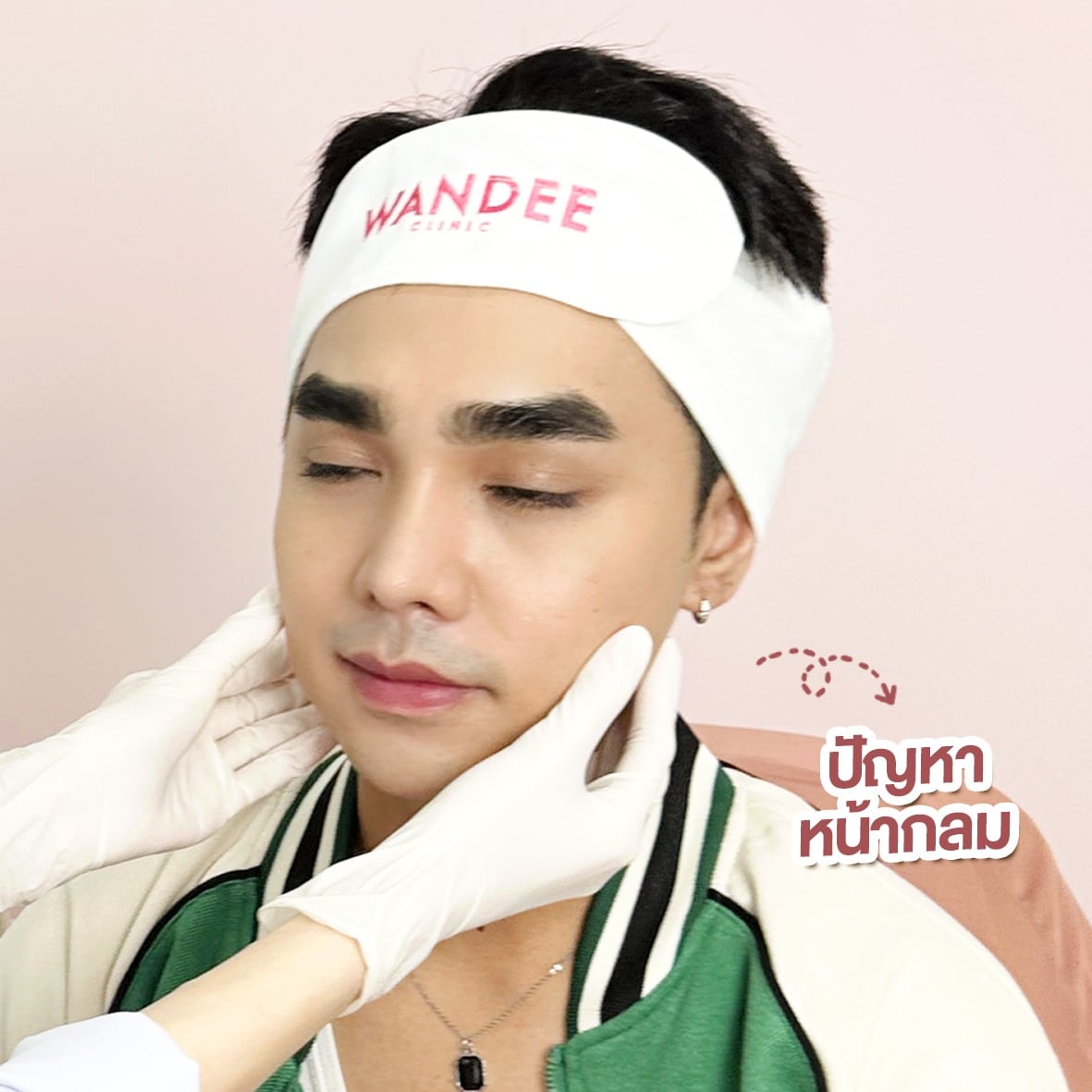 𝐁𝐎 ลดกราม หน้าเรียว