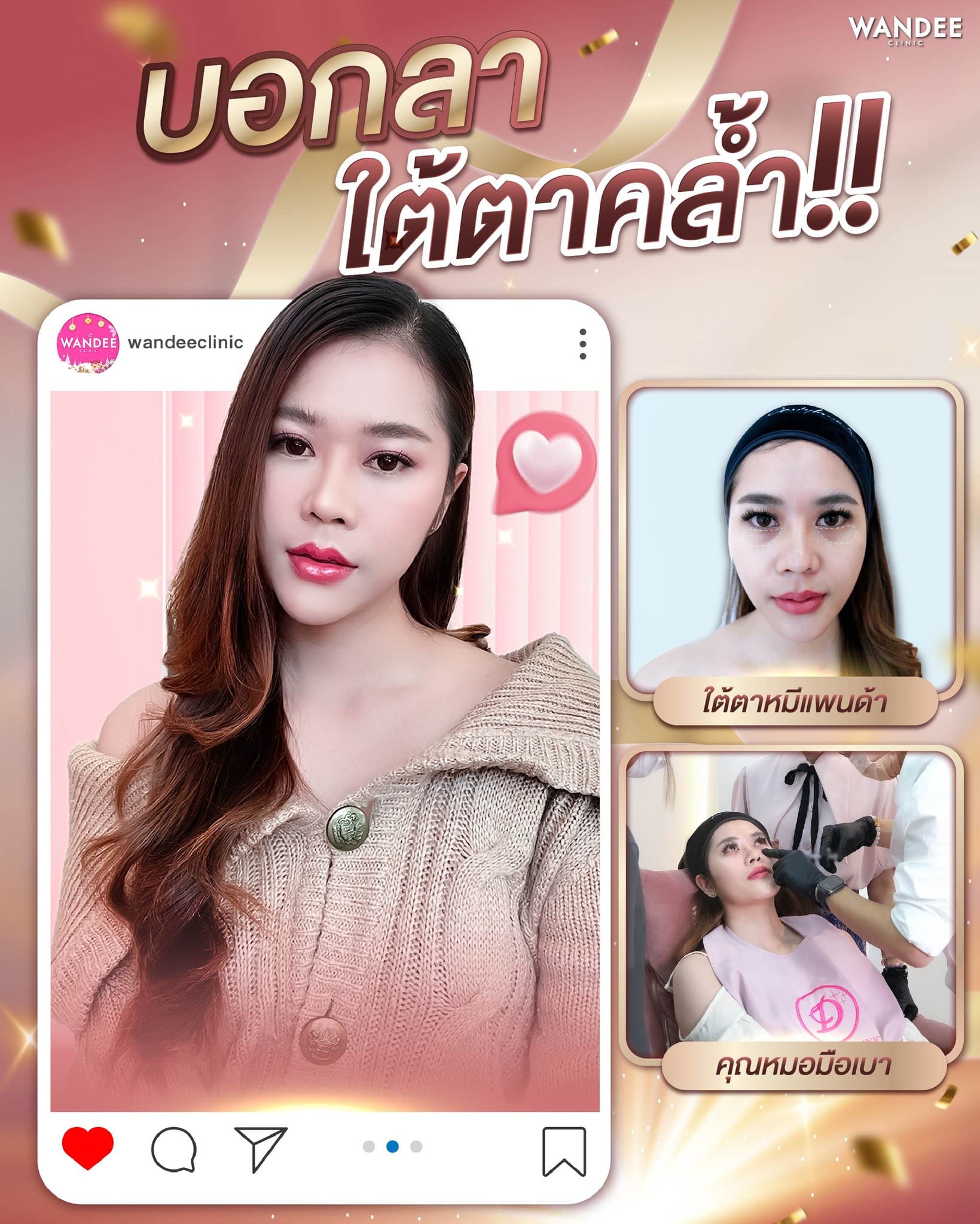 filler แก้ใต้ตาคล้ำ