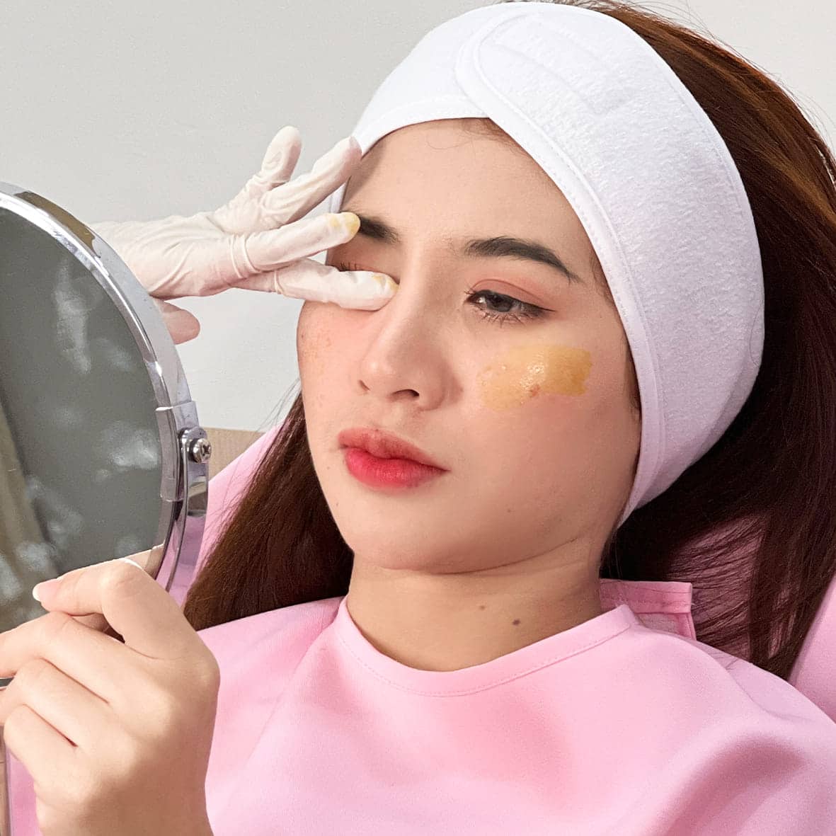 ฟิลเลอร์ใต้ตา