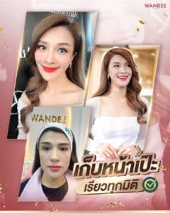 𝗕𝗢 ลดกราม หน้าเรียว