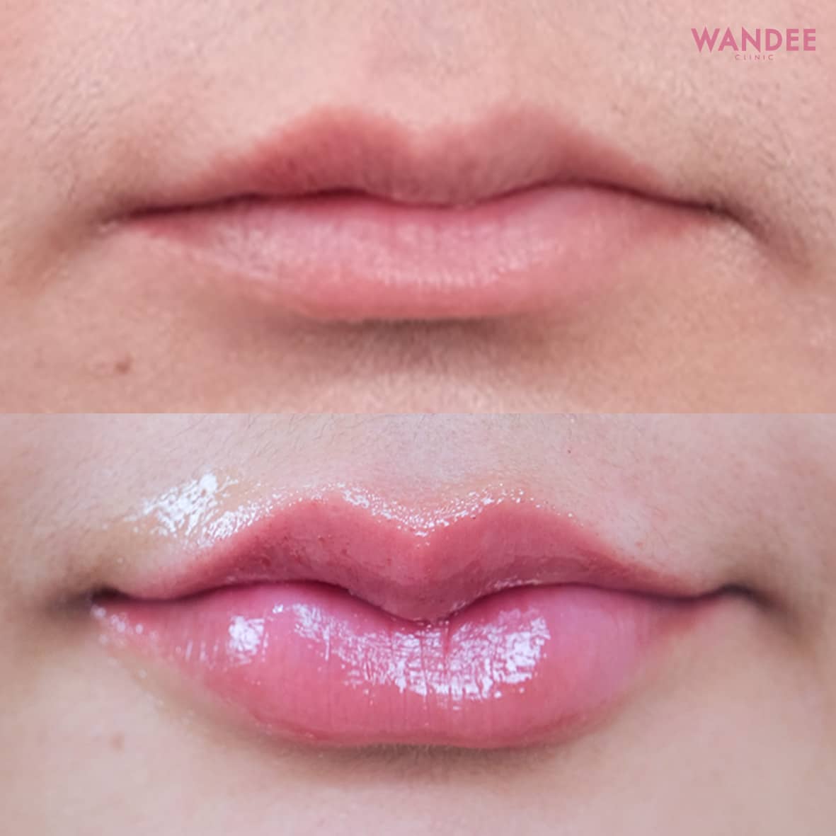 ปากสวยจึ้งละมุน