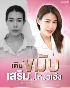 𝗙𝗶𝗹𝗹𝗲𝗿 เติมขมับ