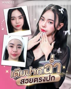 𝗿𝗼𝗴𝗿𝗮𝗺 𝗙𝗶𝗹𝗹𝗲𝗿 เติมปากอิ่มฟูจุใจ