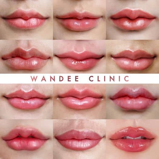 𝐏𝐫𝐨𝐠𝐫𝐚𝐦 𝐅𝐢𝐥𝐥𝐞𝐫 𝟐𝟎𝟐𝟑