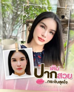 𝗣𝗿𝗼𝗴𝗿𝗮𝗺 𝗙𝗶𝗹𝗹𝗲𝗿