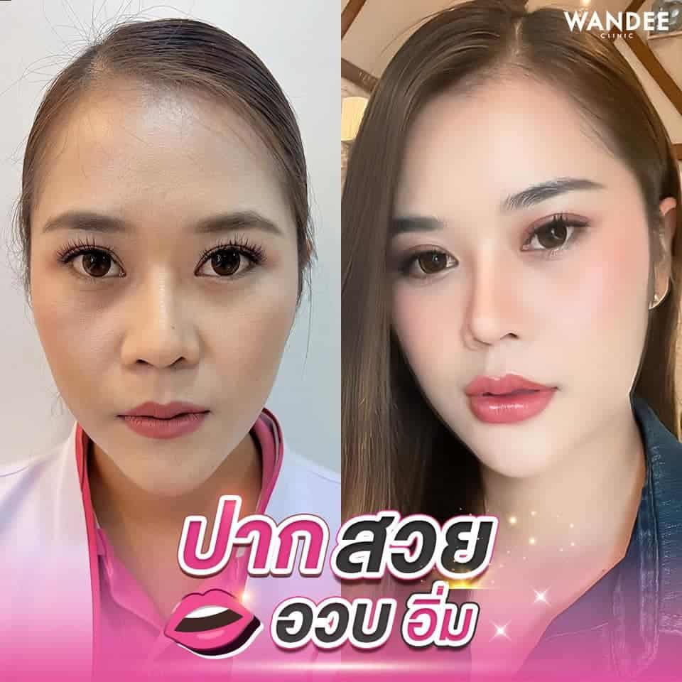 ปากสวยจึ้ง