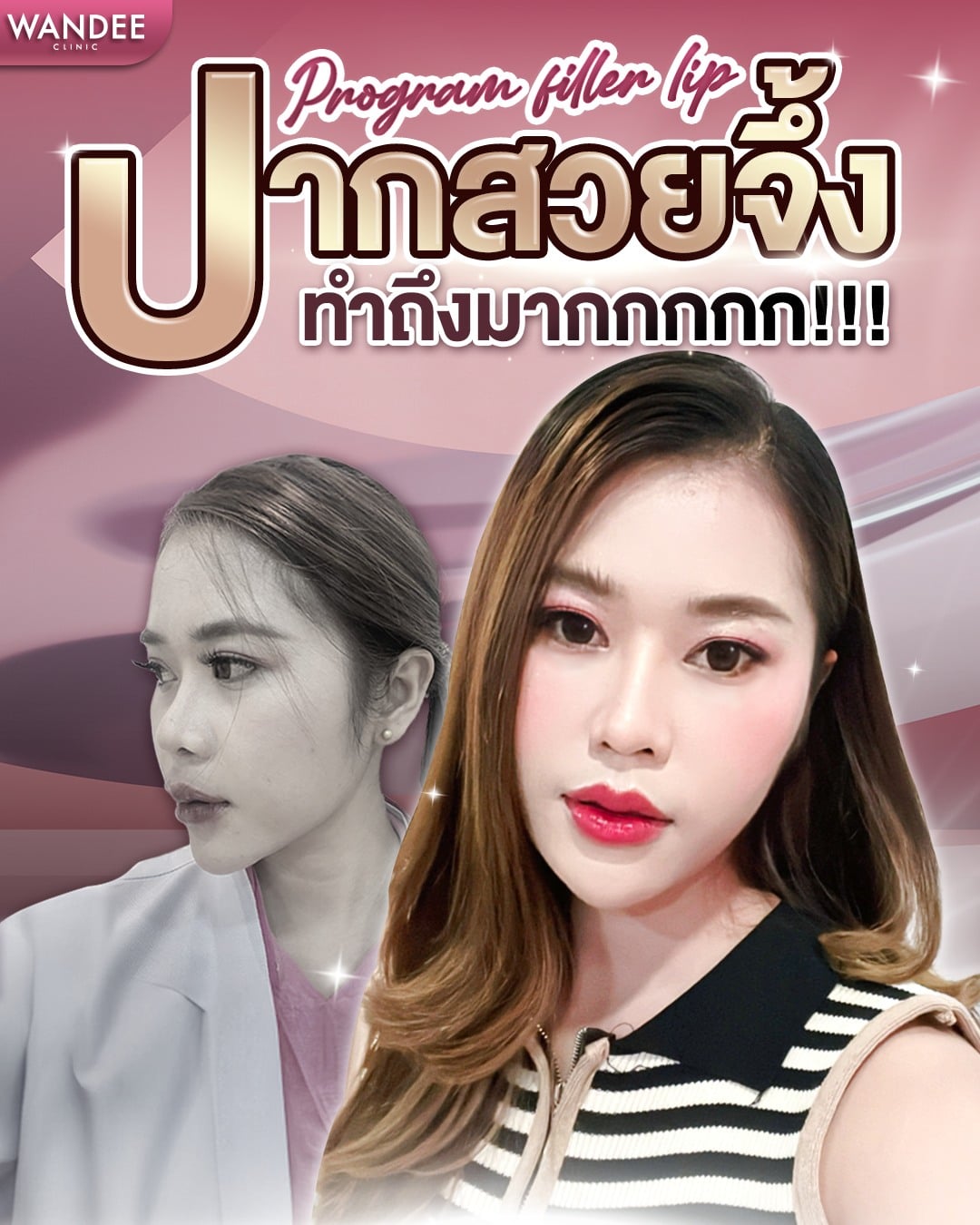ปากสวยจึ้ง