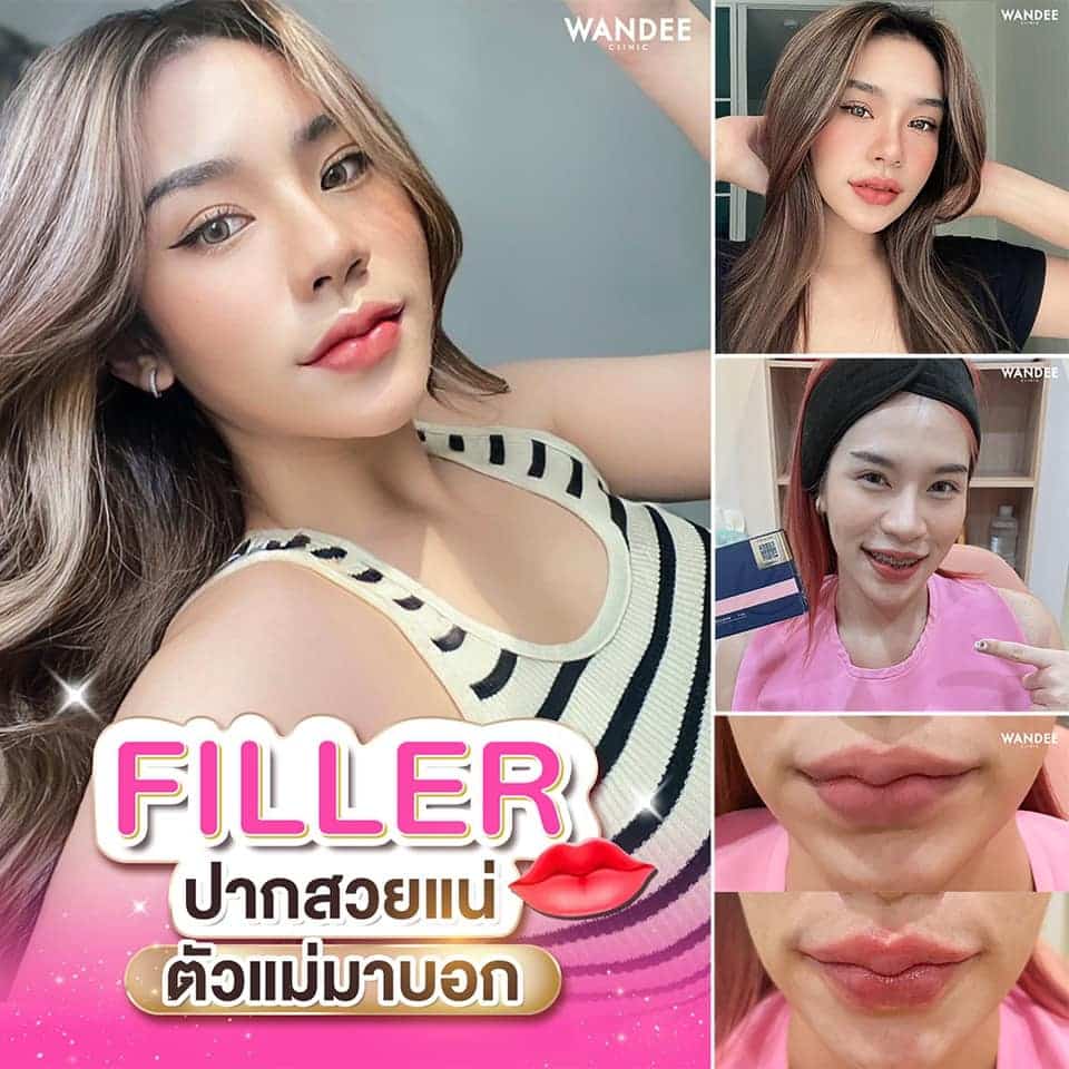 𝗣𝗿𝗼𝗴𝗿𝗮𝗺 𝗙𝗶𝗹𝗹𝗲𝗿