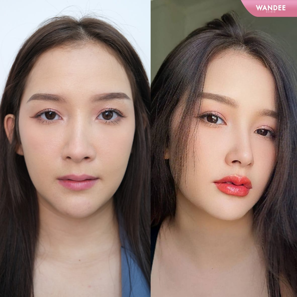 ปากสวย ตรงเรฟ