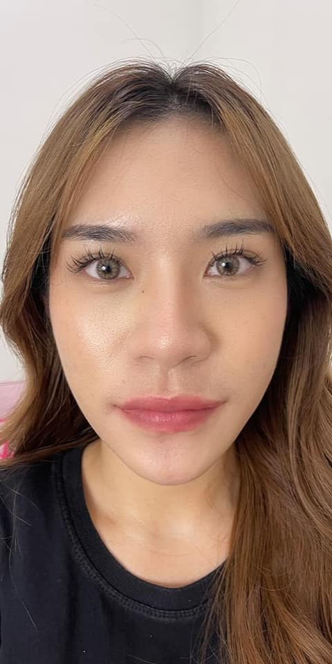 𝗣𝗿𝗼𝗴𝗿𝗮𝗺 𝗙𝗶𝗹𝗹𝗲𝗿 ทุกจุด